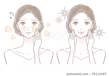 中年婦女患油性皮膚前後 中年婦女患油性皮膚前後 76112487