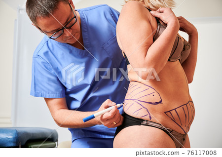 Plastic surgeon marking woman body in clinic. Plastic surgeon marking woman body in clinic. 76117008