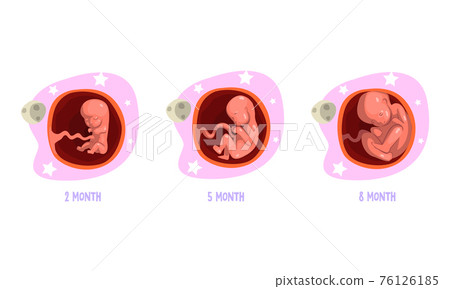Stages of Embryo Development Set, 2, 5, 8 Month Cartoon Vector Illustration Stages of Embryo Development Set, 2, 5, 8 Month Cartoon Vector Illustration 76126185