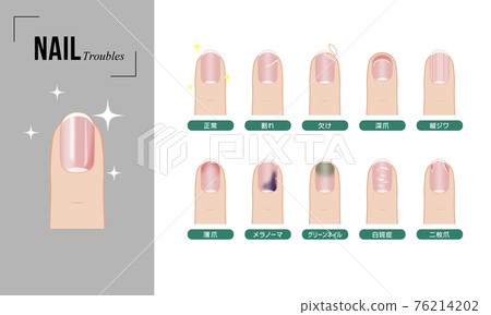 Nail trouble set (color) 76214202