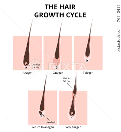 Hair structure Hair structure 76240455