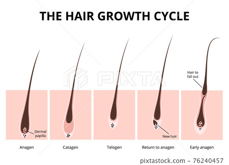Hair structure Hair structure 76240457