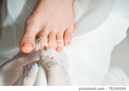 A Podiatrist doctor who takes care of a woman's toenails. Cosmetic procedures of the feet A Podiatrist doctor who takes care of a woman's toenails. Cosmetic procedures of the feet 76249269