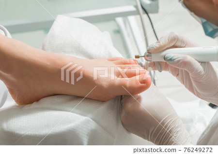 A Podiatrist doctor who takes care of a woman's toenails. Cosmetic procedures of the feet 76249272