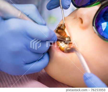 Preteen girl receiving dental filling procedure in pediatric dental clinic Preteen girl receiving dental filling procedure in pediatric dental clinic 76253950