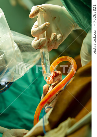 the hands of the surgeon's assistant with a syringe 76265821