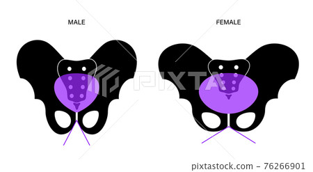 Muscular pelvis concept 76266901