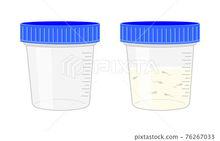 Semen analysis. Sperm sample plastic container empty and full isolated on white background. Male infertility test. Sperm donation concept. Vector cartoon illustration 76267033