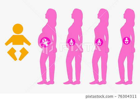 懷孕 懷孕 76304311