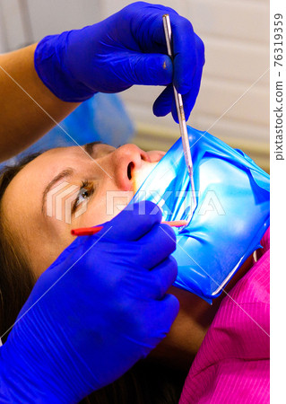 Treatment of the upper sixth left tooth, sterile treatment with roofing felt. 76319359