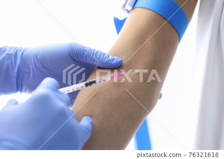 Gloved doctor injects patient into vein closeup Gloved doctor injects patient into vein closeup 76321618