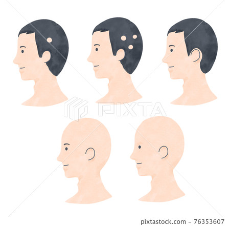 禿頭男性白色背景 76353607