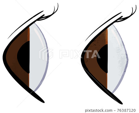 從側面看正常眼和圓錐角膜 從側面看正常眼和圓錐角膜 76387120