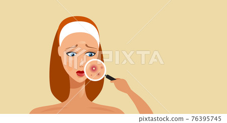 woman having facial skin problems girl using magnifier to find acne on face area portrait horizontal 76395745