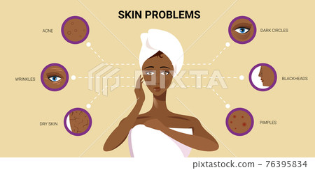 facial skin pimples acne different types on african american woman face pore comedones cosmetology skincare problems concept flat portrait horizontal 76395834