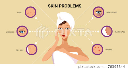 facial skin pimples acne different types on woman face pore comedones cosmetology skincare problems concept flat portrait horizontal 76395844