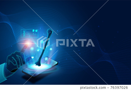bone, medical, vector 76397026