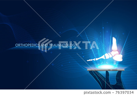 arthritis, bone, foot 76397034