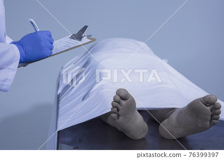 autopsy, postmortem 76399397