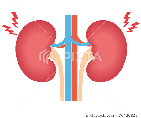 腎泌尿系統發炎 76426825