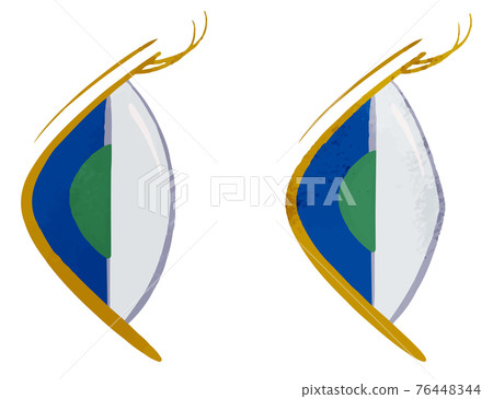 從側面看的正常眼和圓錐角膜眼/藍眼的比較 76448344