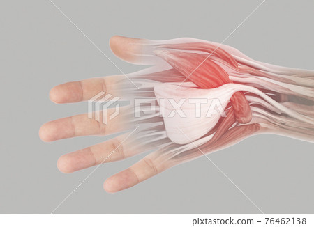 muscle hand pain 76462138
