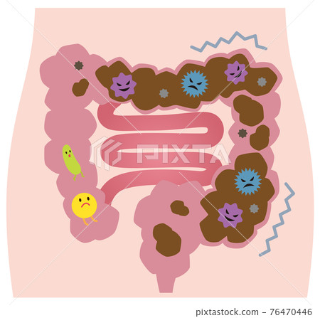 Constipation large intestine intestinal environment bad bacteria 76470446