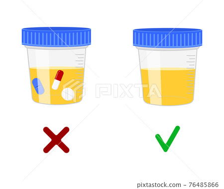 Urinalysis, urine samples with and without drugs. Doping control in sport, post accident drug testing concept. Vector cartoon illustration 76485866