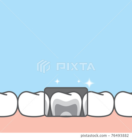Blank banner lower x-ray healthy hygiene teeth illustration vector design on blue background. Dental care concept. Blank banner lower x-ray healthy hygiene teeth illustration vector design on blue background. Dental care concept. 76493882