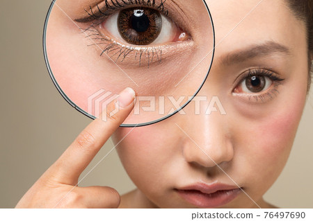 Enlarge the lower eyelid with a loupe. 76497690