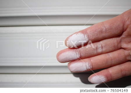 Chalking caulking shutter image shutter 76504149