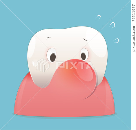 Periodontal disease illustration 76511977