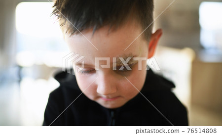 Poor sad small boy with cut eyebrow standing indoors at home, poverty concept. 76514808