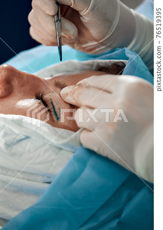 Close up of the face of a patient undergoing blepharoplasty. The surgeon cuts the eyelid and performs manipulations using medical instruments Close up of the face of a patient undergoing blepharoplasty. The surgeon cuts the eyelid and performs manipulations using medical instruments 76519395