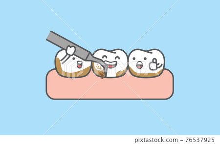 Dental cartoon of cleaning tooth by removing tartar from the teeth illustration cartoon character vector design on blue background. Dental care concept. Dental cartoon of cleaning tooth by removing tartar from the teeth illustration cartoon character vector design on blue background. Dental care concept. 76537925
