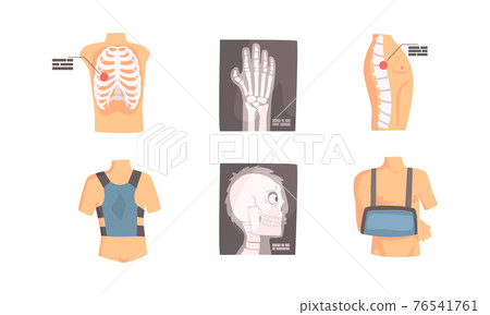 Bone Fractures Set, Medical Examination and Treatment of Back and Spine Injuries Cartoon Vector Illustration 76541761