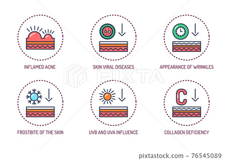 Effect on the skin color line icons set. Human skin layers. Outline pictogram for web page, mobile app, promo. Effect on the skin color line icons set. Human skin layers. Outline pictogram for web page, mobile app, promo. 76545089