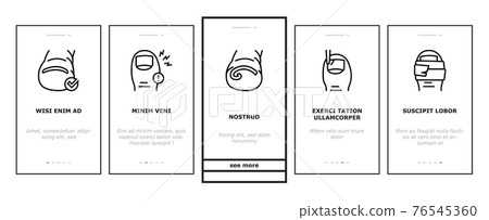 Ingrown Nail Disease Onboarding Icons Set Vector 76545360