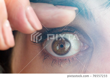 Woman opens her eyes with her fingers for inspection, close-up 76557233