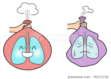 氣球比較健康和虛弱的肺 76572139