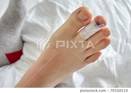 Fracture finger is an insured event for travel insured. 76588510