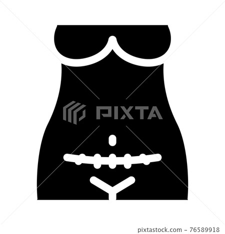 cesarean section icon vector glyph illustration cesarean section icon vector glyph illustration 76589918