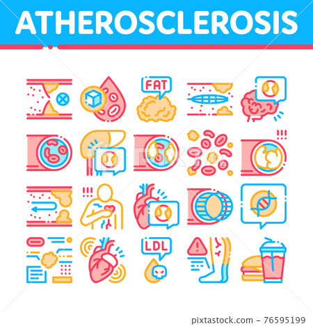 Atherosclerosis Vessel Collection Icons Set Vector Illustrations Atherosclerosis Vessel Collection Icons Set Vector Illustrations 76595199