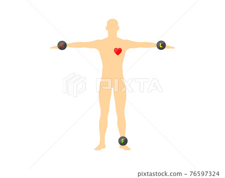 Einthoven ECG triangle, including augmented unipolar limb lead 76597324
