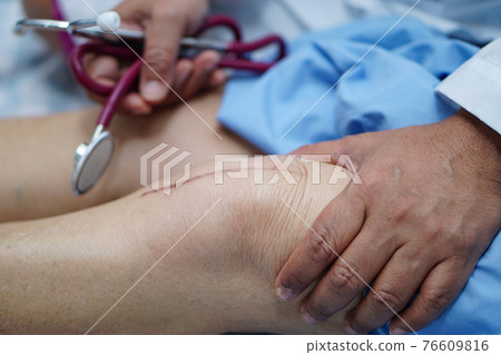 Asian senior or elderly old lady woman patient show her scars surgical total knee joint replacement Suture wound surgery arthroplasty on bed in nursing hospital ward Asian senior or elderly old lady woman patient show her scars surgical total knee joint replacement Suture wound surgery arthroplasty on bed in nursing hospital ward 76609816