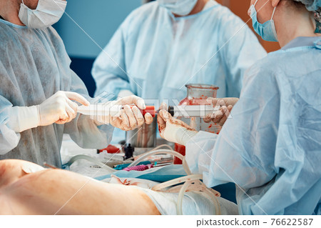 cosmetic liposuction surgery in actual operating room setting showing surgeons group during operation cosmetic liposuction surgery in actual operating room setting showing surgeons group during operation 76622587