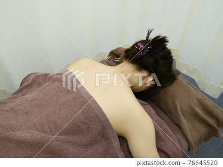 Acupuncture and moxibustion treatment scene 76645520