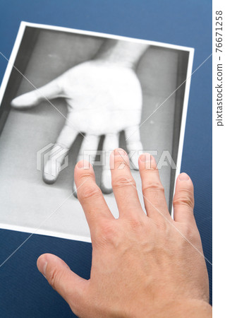 Photocopy of hand Photocopy of hand 76671258