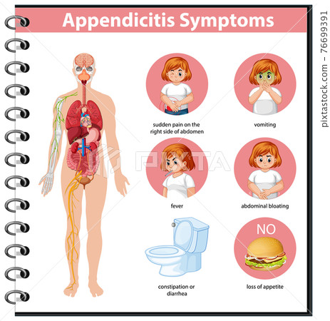 Appendicitis symptoms