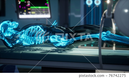 human skeleton bones scan exam in lab 76742275